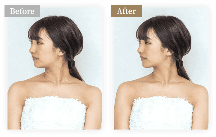 美肌補正 before after